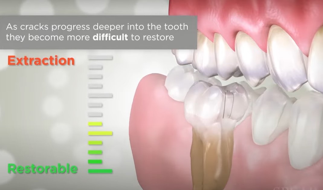 How Long Does It Take to Sell a Dental Practice