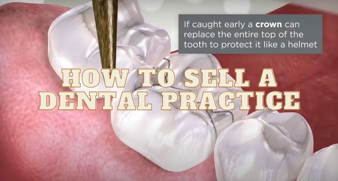 How To Sell A Dental Practıce